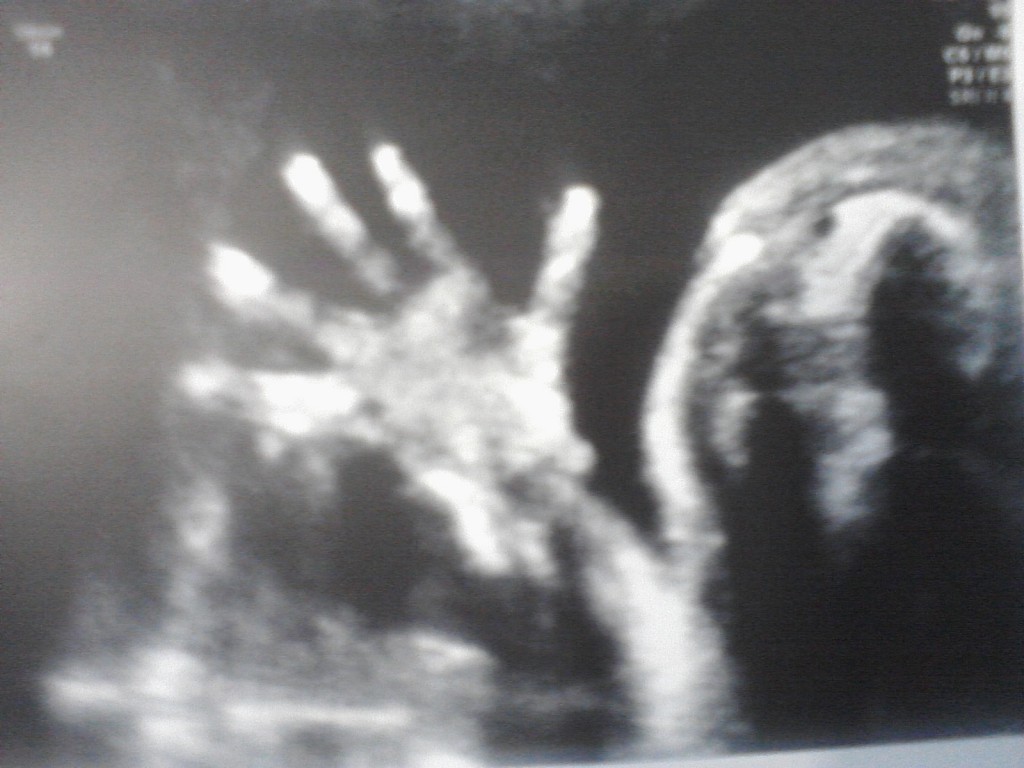 Hand oct 15