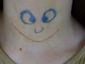 1 scar face